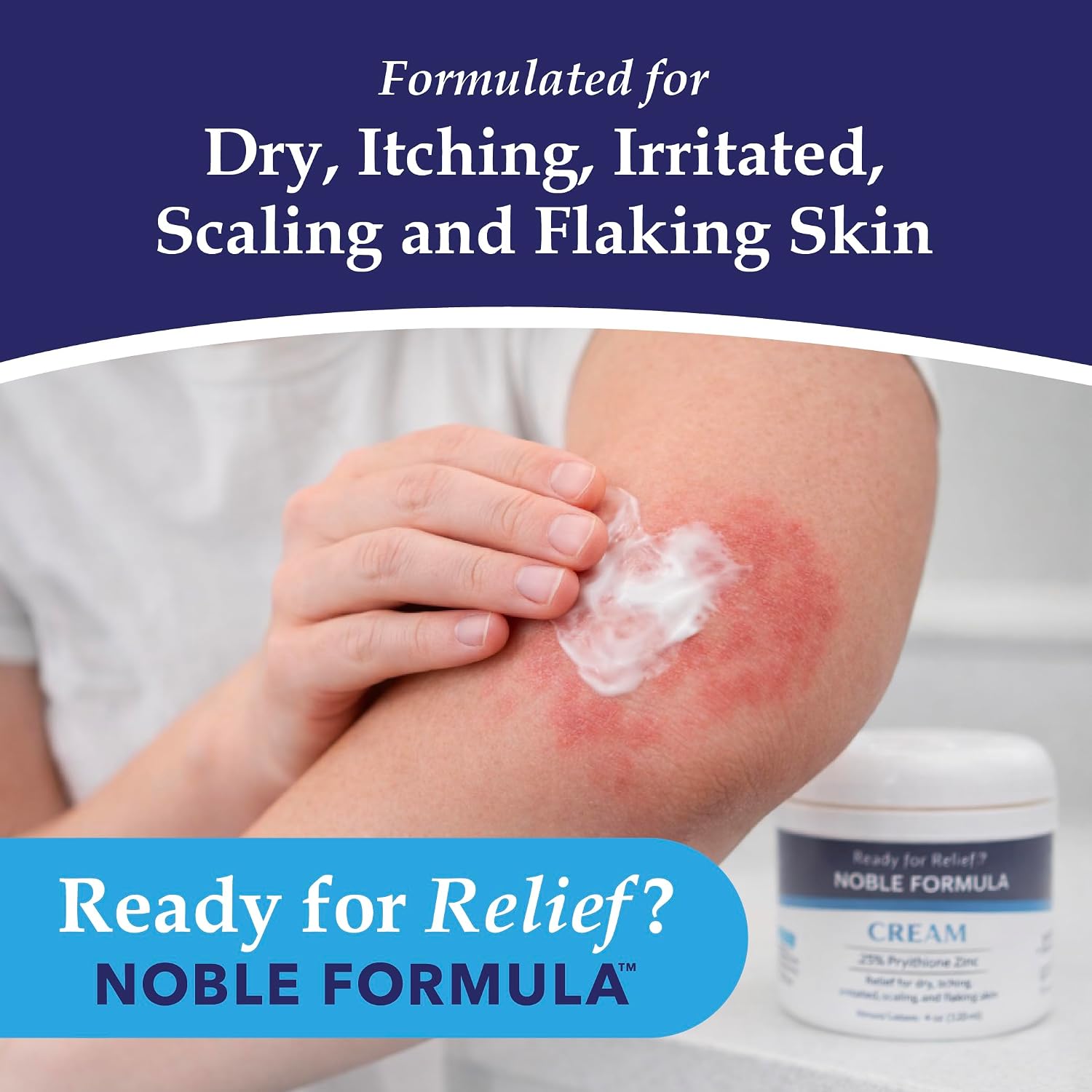 NOBLE FORMULAᵀᴹ CREAM 0.25% Pyrithione Zinc (ZNP) – Noble Formula